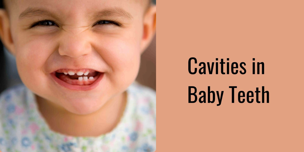 Cavity Care in Baby Teeth: Causes, Prevention, and Treatment