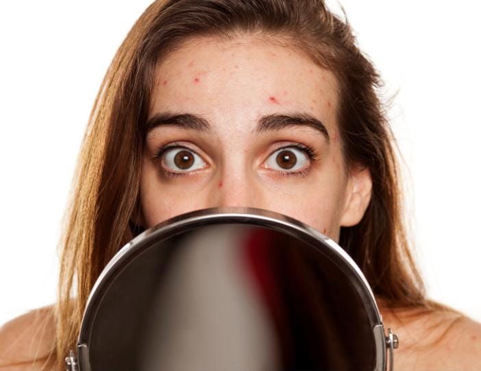 What causes pimples: Types, triggers, remedies & foods.