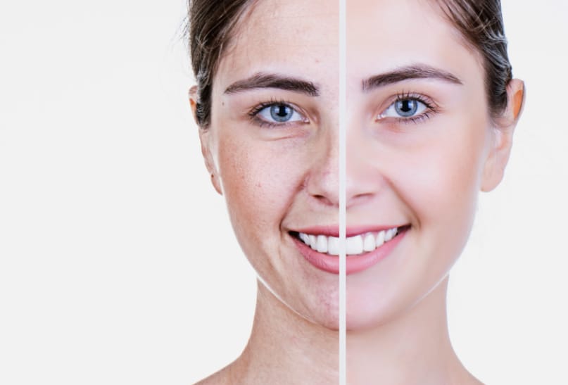 8 proven benefits of using niacinamide for anti-ageing