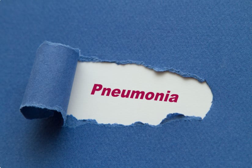 Most Effective Home Remedies And Foods For Pneumonia